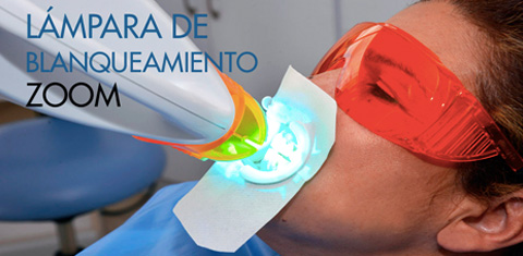 Blanqueamiento Dental